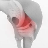 『急に膝が伸ばせなくなり激痛〜半月板損傷と膝のロッキング現象〜』